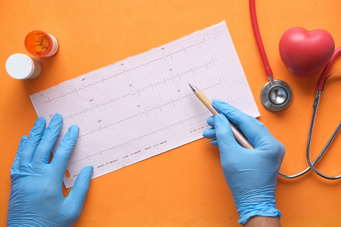 Doctor's gloved hands reviewing ECG printout with a pen.