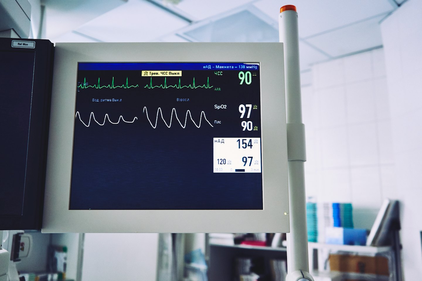 Medical monitor displays patient vital signs and ECG trace.